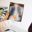 Astmul este o boală cronică de plămâni, caracterizată prin probleme recurente de respiraţie