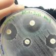 Antibiograma. Foto: microbiolofia 2017