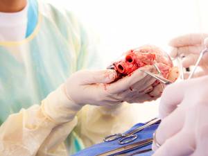 Transplant de inimă. Foto: austria center viena