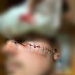 Tăietura provocată polițistului de individul care apoi şi-a ucis bunicul