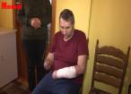 Un bărbat din Bădeuţi cu ambele mâini amputate are nevoie urgent de proteze